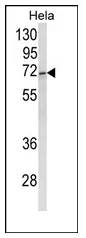 TUG (ASPSCR1) (C-term) Rabbit Polyclonal Antibody - image 1