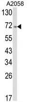 ATF6 (Center) Rabbit Polyclonal Antibody - image 1