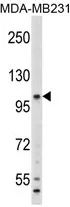 Complement Component 6 (C6) (N-term) Rabbit Polyclonal Antibody - image 1