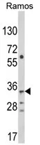 SPATIAL (TBATA) (C-term) Rabbit Polyclonal Antibody - image 1