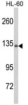 Complement C5 (C5) (N-term) Rabbit Polyclonal Antibody - image 1