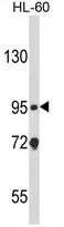 CARD4 (NOD1) (C-term) Rabbit Polyclonal Antibody - image 1