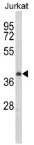 CCR3 Rabbit Polyclonal Antibody - image 1