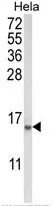 COTL1 (C-term) Rabbit Polyclonal Antibody - image 1
