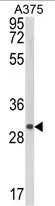 CTHRC1 (N-term) Rabbit Polyclonal Antibody - image 1