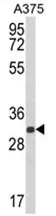 DERA (N-term) Rabbit Polyclonal Antibody - image 1