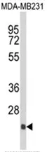 DERL2 (C-term) Rabbit Polyclonal Antibody - image 1