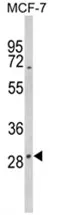 DIO2 (Center) Rabbit Polyclonal Antibody - image 1