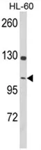 Dynamin 3 (DNM3) Rabbit Polyclonal Antibody - image 1