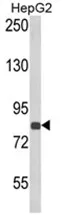 ECE1 Rabbit Polyclonal Antibody - image 1