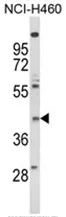 FPR3 Rabbit Polyclonal Antibody - image 1