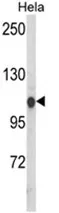 HSPA4L (C-term) Rabbit Polyclonal Antibody - image 1