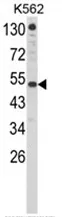 IFNAR1 Rabbit Polyclonal Antibody - image 1
