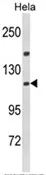 IPO11 (N-term) Rabbit Polyclonal Antibody - image 1