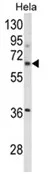 OSCP (ITGBL1) Rabbit Polyclonal Antibody - image 1