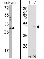 CAPZB (C-term) Rabbit Polyclonal Antibody - image 1
