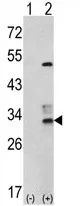 CAPZB (N-term) Rabbit Polyclonal Antibody - image 1