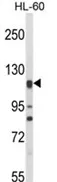 eNOS (NOS3) (N-term) Rabbit Polyclonal Antibody - image 1