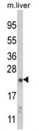 NQO2 Rabbit Polyclonal Antibody - image 1