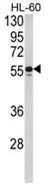 LXR beta (NR1H2) (N-term) Rabbit Polyclonal Antibody - image 1