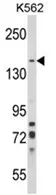 SORCS1 (N-term) Rabbit Polyclonal Antibody - image 1