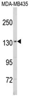 SREBP1 (SREBF1) (Center) Rabbit Polyclonal Antibody - image 1