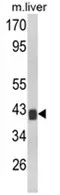 TOB (TOB1) (N-term) Rabbit Polyclonal Antibody - image 1