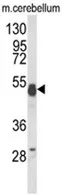 UBAP1 (N-term) Rabbit Polyclonal Antibody - image 1