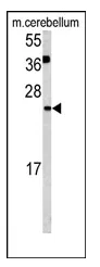 Glutaredoxin 2 (GLRX2) (C-term) Rabbit Polyclonal Antibody - image 1