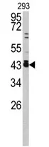 c Fos (FOS) (C-term) Rabbit Polyclonal Antibody - image 1