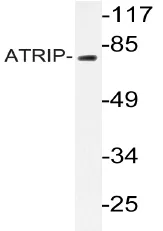ATRIP Rabbit Polyclonal Antibody - image 1