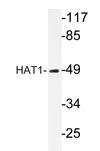 HAT1 Rabbit Polyclonal Antibody - image 1