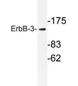 ErbB 3 (ERBB3) Rabbit Polyclonal Antibody - image 1