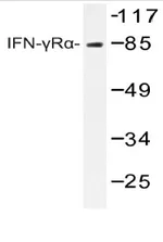 IFNGR1 Rabbit Polyclonal Antibody - image 1