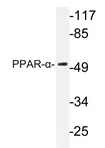 PPAR alpha (PPARA) Rabbit Polyclonal Antibody - image 1