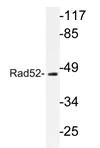 RAD52 Rabbit Polyclonal Antibody - image 1