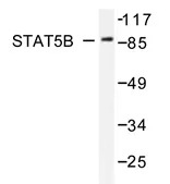STAT5B Rabbit Polyclonal Antibody - image 1