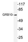 GRB10 Rabbit Polyclonal Antibody - image 1