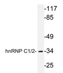 HNRNPC Rabbit Polyclonal Antibody - image 1