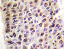 KAT5 Rabbit Polyclonal Antibody - image 1