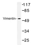 Vimentin (VIM) Rabbit Polyclonal Antibody - image 1