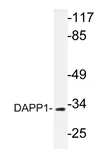 DAPP1 Rabbit Polyclonal Antibody - image 1