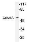 CDC25A Rabbit Polyclonal Antibody - image 1