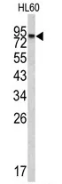 CPXM2 (N-term) Rabbit Polyclonal Antibody - image 1