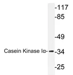 Casein Kinase 1 alpha (CSNK1A1) Rabbit Polyclonal Antibody - image 1