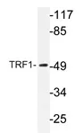TRF1 (TERF1) Rabbit Polyclonal Antibody - image 1