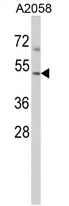 Arp3 (ACTR3) (C-term) Rabbit Polyclonal Antibody - image 1