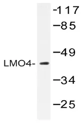 LMO4 Rabbit Polyclonal Antibody - image 1