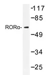 ROR alpha (RORA) Rabbit Polyclonal Antibody - image 1