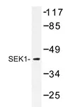 MEK4 (MAP2K4) Rabbit Polyclonal Antibody - image 1